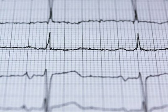 Alto rischio di scompenso cardiaco in caso di infarto miocardico per le donne trattate con beta-bloccanti