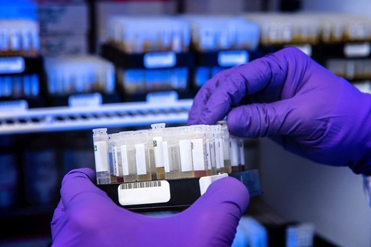 ECLIPSE: il futuro della diagnostica parte da Bologna con il contributo chiave del Dipartimento di Scienze Mediche e Chirurgiche ECLIPSE: il futuro della diagnostica parte da Bologna con il contributo chiave del Dipartimento di Scienze Mediche e Chirurgiche