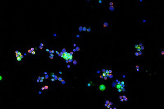 Tumori ematologici e CAR-T: nel nanomondo i messaggi cellulari che predicono il futuro