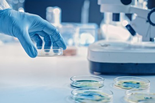 Un nuovo strumento per valutare il rischio di mieloma multiplo